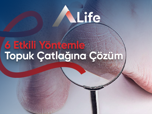 6 Etkili Yöntemle Topuk Çatlağına Çözüm